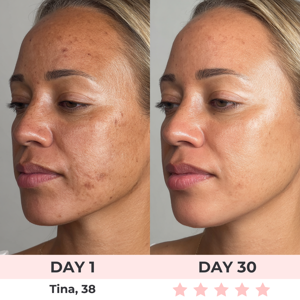 Zovya™ 3-in-1 LED Face Sculptor