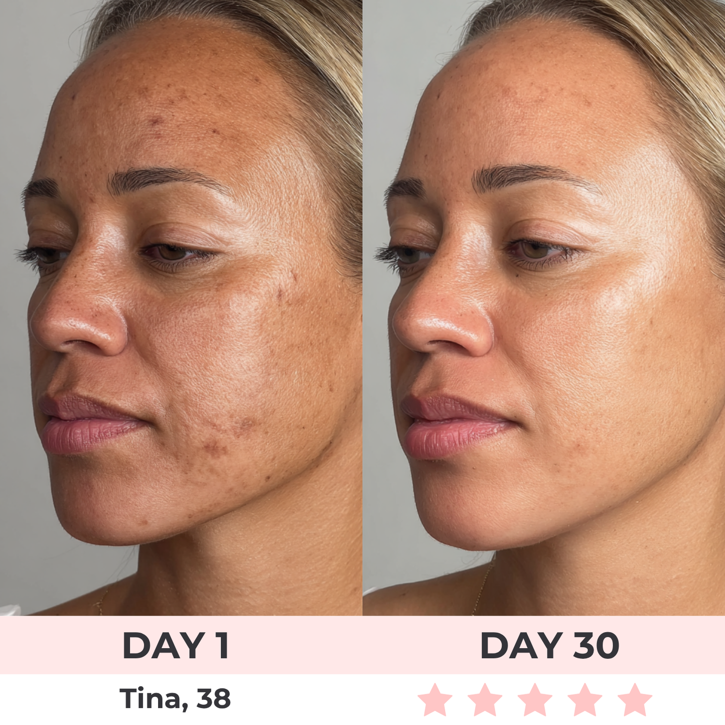 Zovya™ 3-in-1 LED Face Sculptor