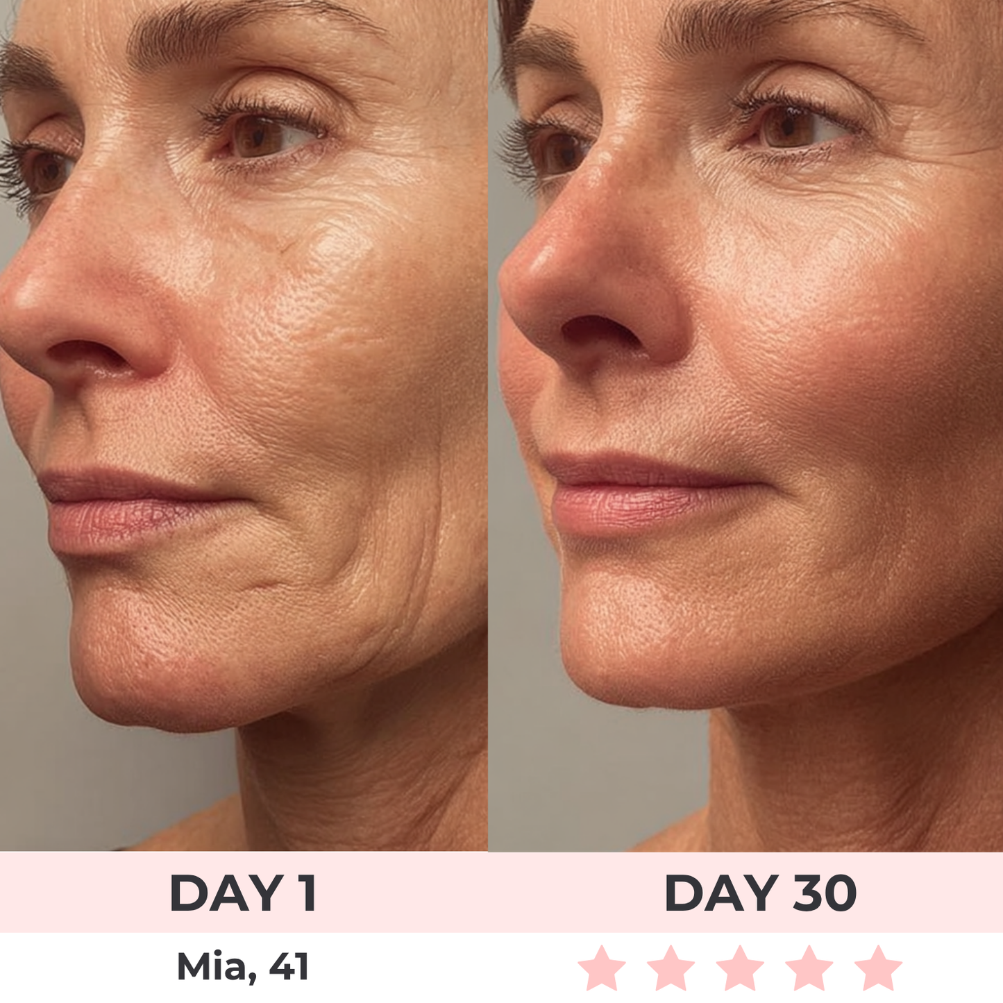 Zovya™ 3-in-1 LED Face Sculptor