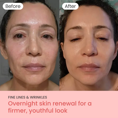 KOEC™ Collagen Night Wrapping Mask